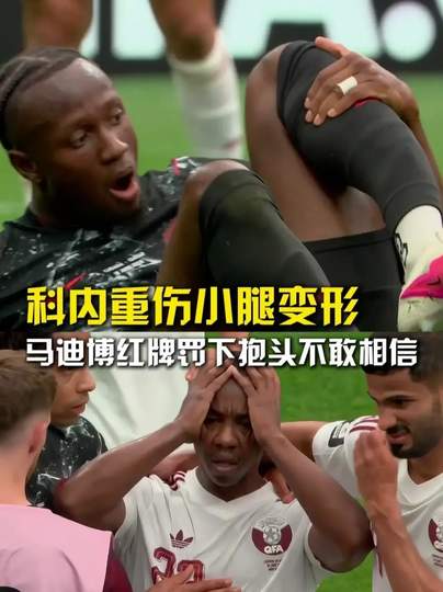 加拿大前锋惨烈骨折引震动，俱乐部紧急叫停转会谈判